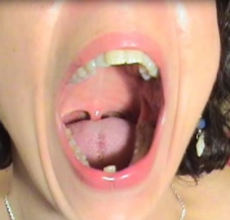 Neck  Throat Fetish Clip - Watch my beautiful neck swallowing and tightening. Let me open my up to view the back of my pharynx. Popping my uvula up and down for you. Perfect lighting!