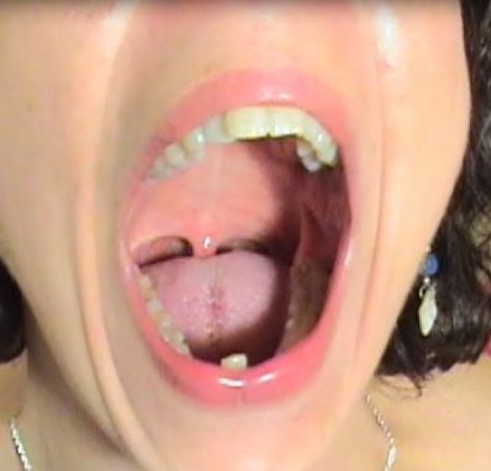 Neck  Throat Fetish Clip